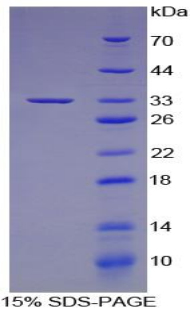 SDS-PAGE